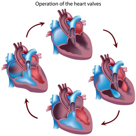 Operation on the heart valve