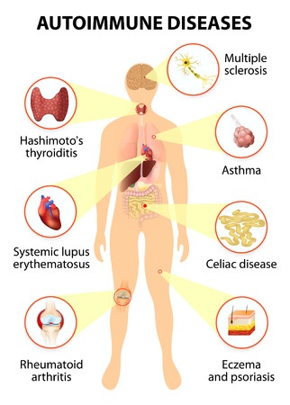 Autoimmune diseases