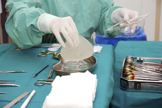 Breast implants for mammoplasty