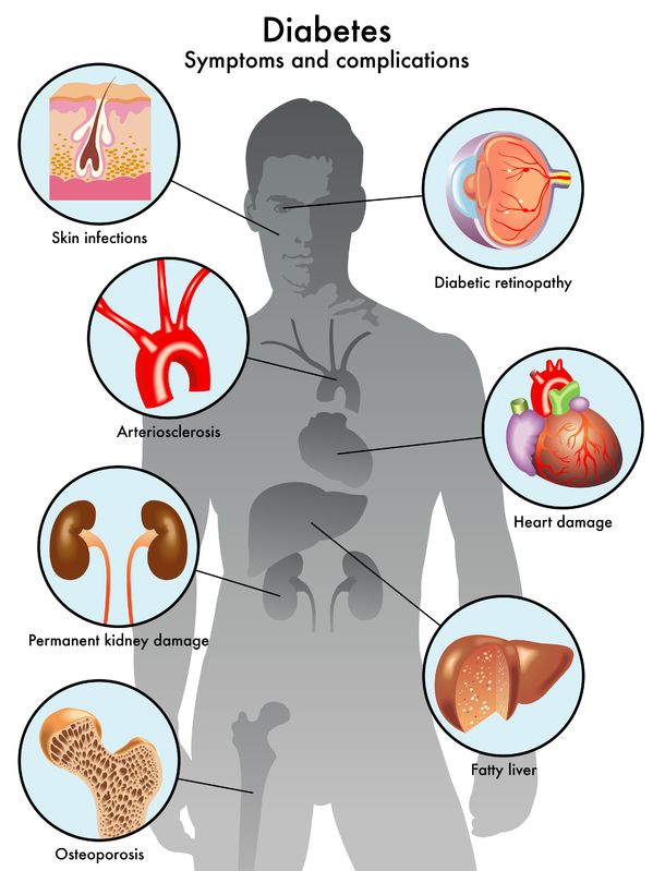 Diabetes (symptoms and complications)