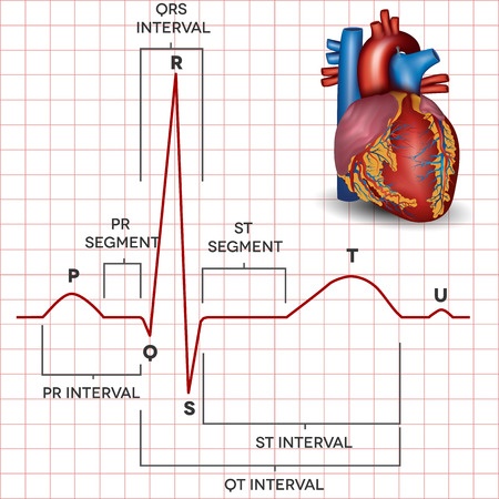 Treatment of atrial fibrillation